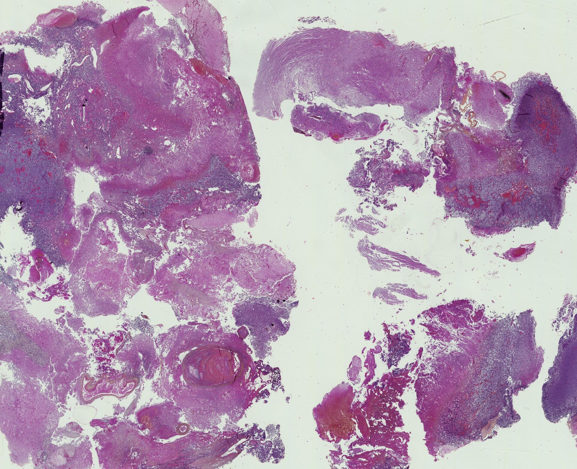 Histology slide