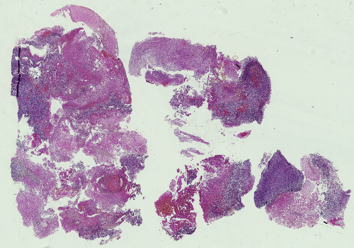 Histopathology Image