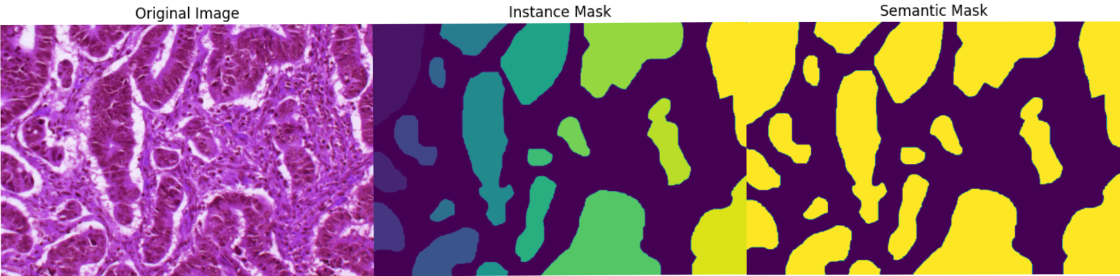 Segmentation Image